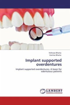 Implant supported overdentures - Bhatia, Vishwas;Bhatia, Garima