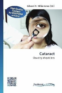 Cataract