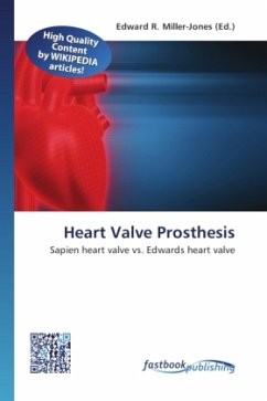 Heart Valve Prosthesis