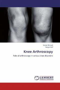 Knee Arthroscopy - Ahmad, Sohail;Asif, Naiyer