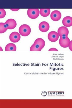 Selective Stain For Mitotic Figures - Jadhav, Kiran;Mujib, Ahmed;Gupta, Nidhi