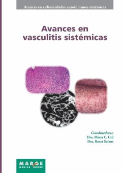 Avances en vasculitis sistémicas - Solans, Roser; Cid, María C; Cervera, Ricard