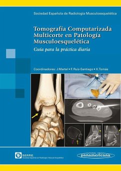 Tomografía computarizada multicorte en patología musculoesquelética : guía para la práctica diaria - Sociedad Española Radiología Músculo-Esquelética