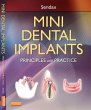 Mini Dental Implants - Bild 1