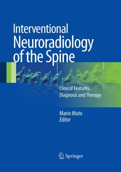 Interventional Neuroradiology of the Spine