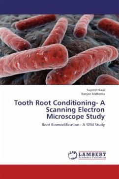 Tooth Root Conditioning- A Scanning Electron Microscope Study