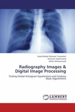 Radiography Images & Digital Image Processing - Moosavi Toomatari, Seyed Babak;Sepehrvand, Nariman;Mohammadi, Afshin
