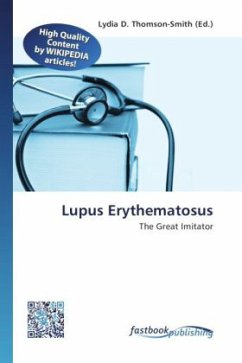 Lupus Erythematosus