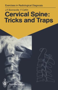 Cervical Spine: Tricks and Traps - Bonneville, Jean-Francois; Cattin, Francoise