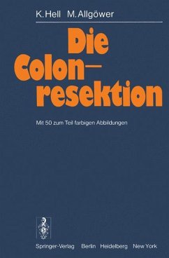 Die Colonresektion - Hell, K.;Allgöwer, M.