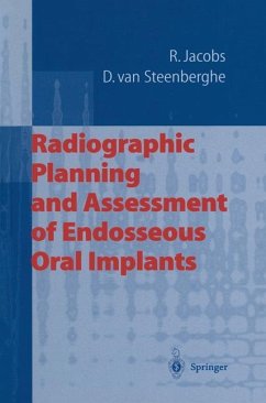 Radiographic Planning and Assessment of Endosseous Oral Implants - Jacobs, Reinhilde;Steenberghe, Daniel van
