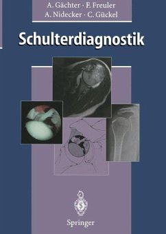 Schulterdiagnostik - Gächter, Andre; Freuler, Franz; Nidecker, Andreas; Gückel, Claudius