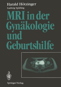 MRI in der Gynäkologie und Geburtshilfe - Hötzinger, Harald