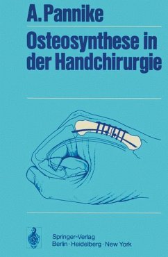 Osteosynthese in der Handchirurgie - Pannike, A.