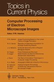 Computer Processing of Electron Microscope Images