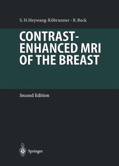 Contrast-Enhanced MRI of the Breast - Heywang-Köbrunner, Sylvia; Beck, Rainer