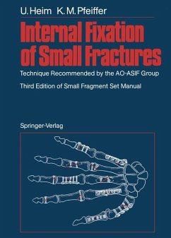 Internal Fixation of Small Fractures - Heim, Urs; Pfeiffer, Karl M.