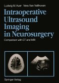 Intraoperative Ultrasound Imaging in Neurosurgery