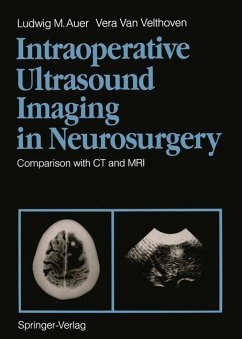 Intraoperative Ultrasound Imaging in Neurosurgery - Auer, Ludwig M.; Velthoven, Vera Van