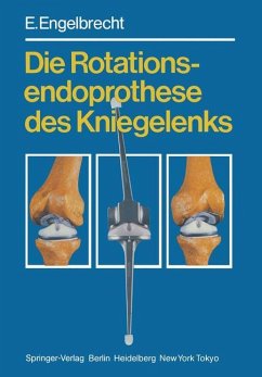 Die Rotationsendoprothese des Kniegelenks - Engelbrecht, E.