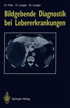 Bildgebende Diagnostik bei Lebererkrankungen - Felix, Roland; Langer, Ruth; Langer, Mathias