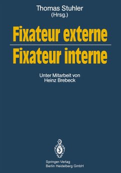 Fixateur externe ¿ Fixateur interne