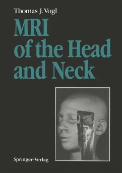 MRI of the Head and Neck - Vogl, Thomas J.