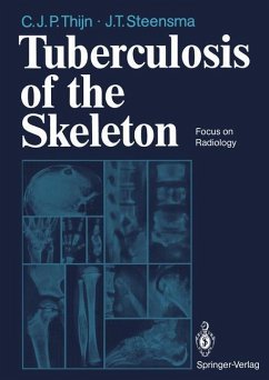 Tuberculosis of the Skeleton - Thijn, Cornelis J.P.; Steensma, Jieldouw T.