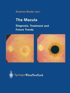 The Macula