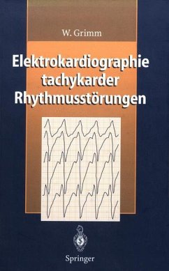 Elektrokardiographie tachykarder Rhythmusstörungen - Grimm, W.