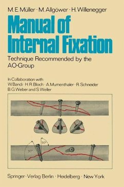 Manual of Internal Fixation - Willenegger, H.;Allgöwer, M.;Müller, M. E.