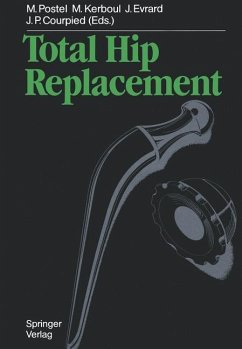 Total Hip Replacement