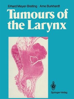Tumours of the Larynx - Meyer-Breiting, Erhard; Burkhardt, Arne.