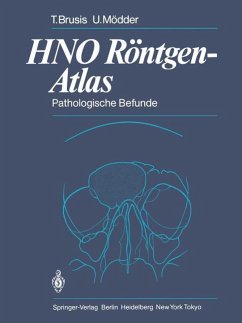 HNO Röntgen-Atlas - Brusis, Tilman;Mödder, Ulrich