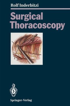 Surgical Thoracoscopy - Inderbitzi, Rolf G. C.