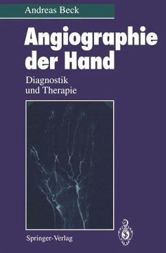 Angiographie der Hand - Beck, Andreas