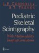 Pediatric Skeletal Scintigraphy - Bild 1