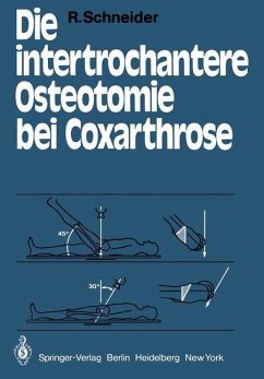 Die intertrochantere Osteotomie bei Coxarthrose - Schneider, R.