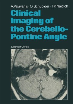 Clinical Imaging of the Cerebello-Pontine Angle - Valavanis, Anton; Schubiger, Othmar; Naidich, Thomas P.