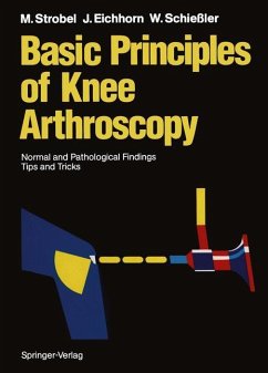 Basic Principles of Knee Arthroscopy - Strobel, Michael; Eichhorn, Heinz-Jürgen; Schießler, Wilfried