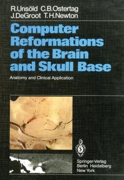 Computer Reformations of the Brain and Skull Base - Unsöld, R.; Ostertag, C. B.; DeGroot, J.; Newton, T. H.