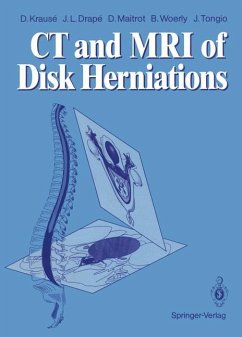CT and MRI of Disk Herniations - Krause, Denis; Drape, Jean L.; Maitrot, Daniel; Woerly, Bernard; Tongio, Jean