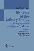 Diseases of the Salivary Glands Including Dry Mouth and Sjögren¿s Syndrome