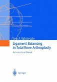 Ligament Balancing in Total Knee Arthroplasty