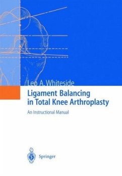 Ligament Balancing in Total Knee Arthroplasty - Whiteside, Leo A.