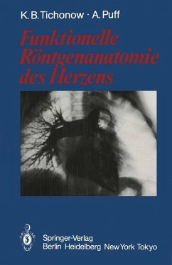 Funktionelle Röntgenanatomie des Herzens - Tichonow, Konstantin B.; Puff, Alexander