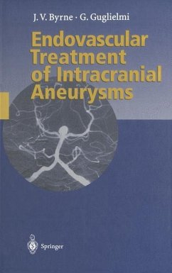 Endovascular Treatment of Intracranial Aneurysms - Byrne, James;Guglielmi, Guido