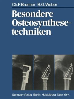 Besondere Osteosynthesetechniken - Brunner, C. F.;Weber, B. G.