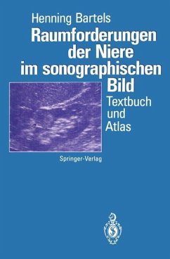 Raumforderungen der Niere im sonographischen Bild - Bartels, Henning