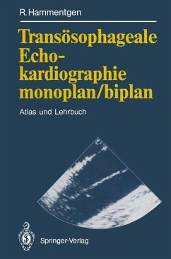 Transösophageale Echokardiographie monoplan/biplan - Hammentgen, Ralf